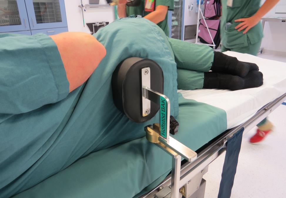 Patientens överkropp ska ligga nära kanten så att den skadade armen kan hänga utanför operationsbordet.