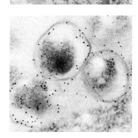 Man fann nämligen i en studie att Chlamydia-antikroppar tillsammans med förhöjt lipoprotein (a) var kopplade till vissa HLA-DR-typer [10].