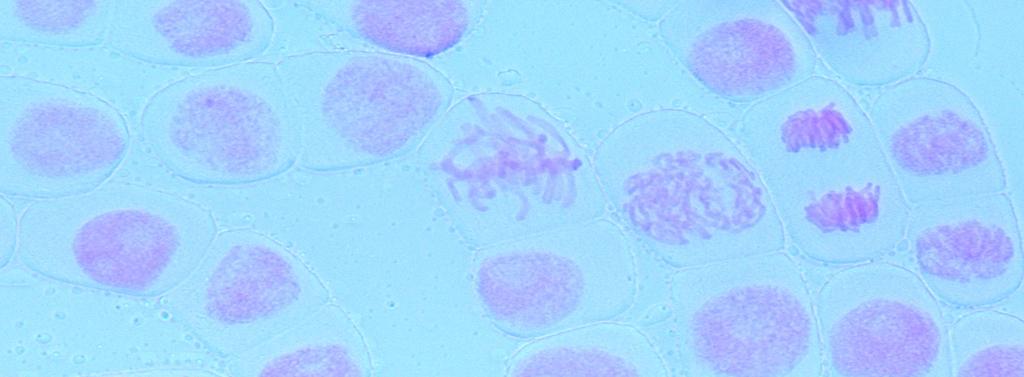 Kromosomjakt mitos i vitlöksrötter (Lärarhandledning) Mikroskopbild av rotceller från vitlök 400x förstoring.