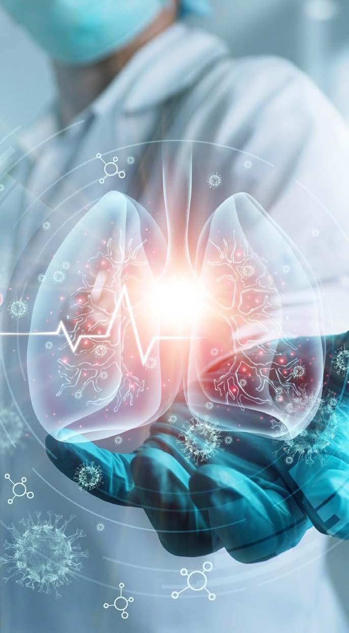 COVID-19 SARS-CoV-2 Corona virus disease 2019 (COVID-19) är en viral luftvägsinfektion orsakad av det nyligen framväxande viruset "severe acute respiratory syndrome coronavirus 2" (SARS-CoV-2) och