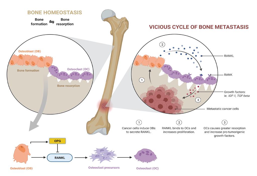 Figure 9. Schematic illustration of the bone homeostasis in normal condition and cancer bone metastasis vicious cycle 1.3.2.