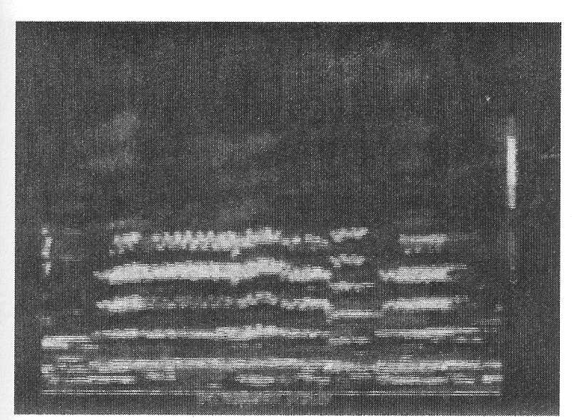 Vågiga linjer indikerar vibrato (Miller 2002 s 73). Fig 4: Frekvensanalys av Ethel Mermans röst (1908-1984, amerikansk musikalsångerska).