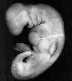 Figur 5: Foto av ett 28- dagars embryo i mudghahstadiet. Embryot har i detta stadiet likheter med tuggad substans, därför att märken längs embryots rygg liknar tandmärken i en tuggad substans.