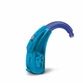 Bakom- örat apparat med extern hörtelefon Ett alternativ för äldre barn är hörapparater med hörtelefon i hörselgången. Mikrofonen sitter i höljet, men hörtelefonen placeras i hörselgången.