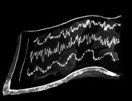 Mer avancerad är den metod som kallas MRT (magnetisk resonanstomografi). Vid denna metod påverkar en magnet kroppens atomer. En dator används för att framställa bilder av hjärnan.