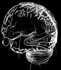 Medulla Ryggmärgen Tinninglob (temporallob) Lillhjärnan (cerebellum)
