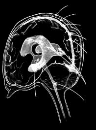 opticum) Synstrålningen (radiatio optica) Hjärnbarken (cortex)