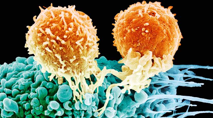 Bild: Nissim Benvenisty När en klump odlade ospecialiserade stamceller utvecklas mot nervceller växer utskott, som sträcker sig allt längre bort från den ursprungliga klumpen.
