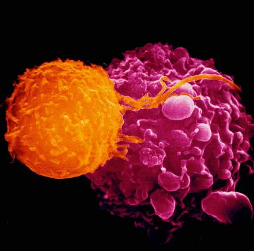 Immunförsvaret spelar en viktig roll för att skydda oss mot cancer. Det dödar de flesta celler som är på väg att bilda tumörer, långt innan vi märker något av det hela.