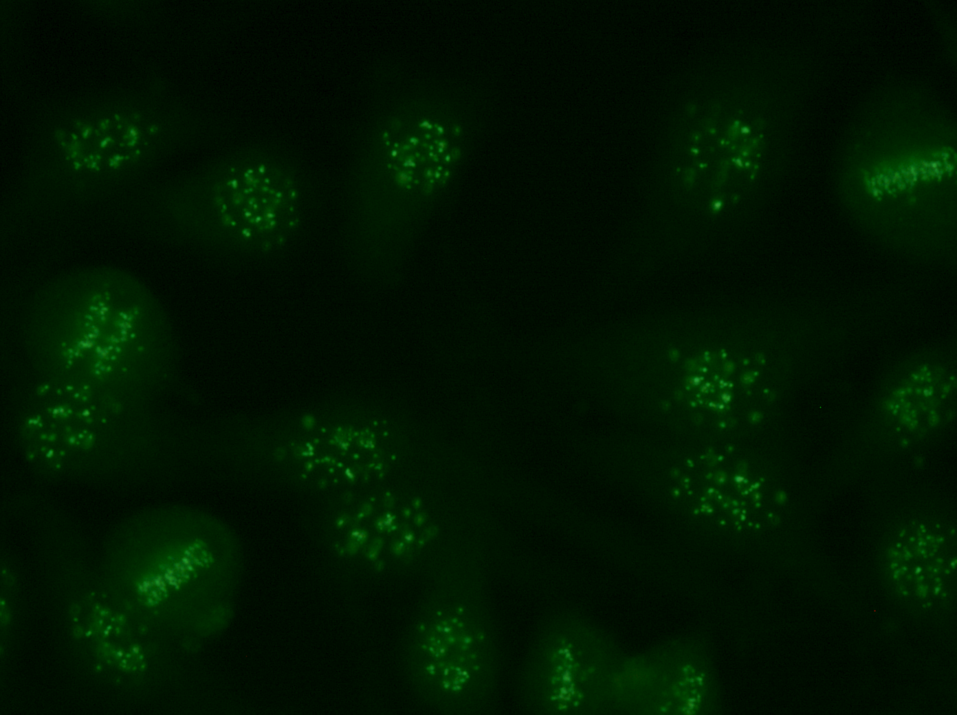 I prover som är DNA-, DNP- och/eller histon-negativa (t ex Immuno Concepts fläckiga positiva kontroll) uppvisar de mitotiska cellerna inte någon kromsomfärgning, och kan därför vara svåra att se.