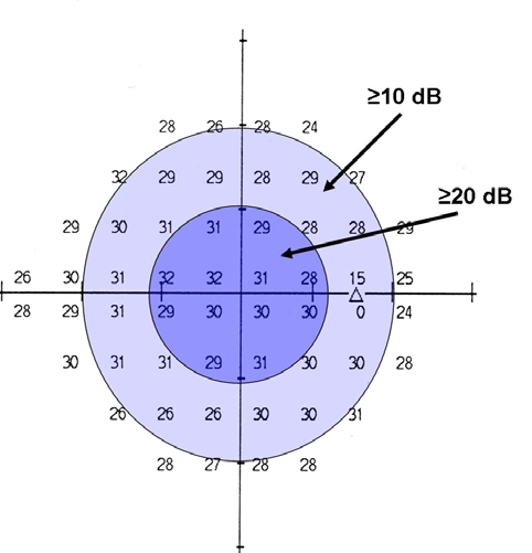 Inom de centrala 20 graderna ska värdet i varje korresponderande testpunkt vara minst 10 db (en enda testpunkt med ett värde understigande 10 db accepteras om den ligger utanför de centrala 10