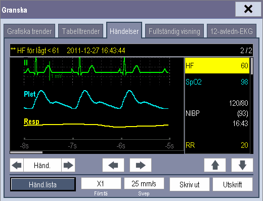 1 2 1. Kurvområde 2. Parameterområde I det här fönstret: Du kan välja eller för att navigera genom kurvorna. Du kan växla mellan olika händelser genom att välja eller bredvid [Händelse].