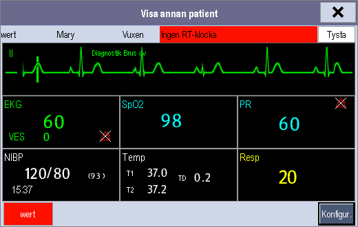 6.4.3 Förstå fönstret Visa annan patient Första gången du öppnar fönstret [Visa annan patient] väljer patientmonitorn automatiskt en monitor från nätverket som visas i fönstret [Visa annan patient].