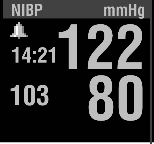Procedur vid enstaka manuella mätningar NIBP-mätningen tar normalt 40 sekunder att bli klar. Om mätningen inte blivit klar inom 120 sekunder töms manschetten automatiskt.