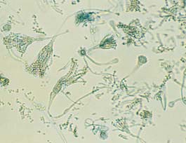 D=Alternaria. Ljusmikroskopbild av sporer (konidier).