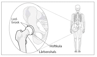 Länskliniken Ortopedi Ansvarig: Lars Lundmark.
