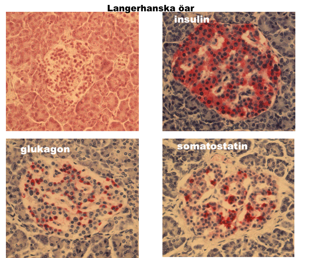 Varje Langerhansk ö består av endokrina celler, endotel celler som hör till blodbanan, bindvävsceller samt celler såsom makrofager som hör till immunsystemet.