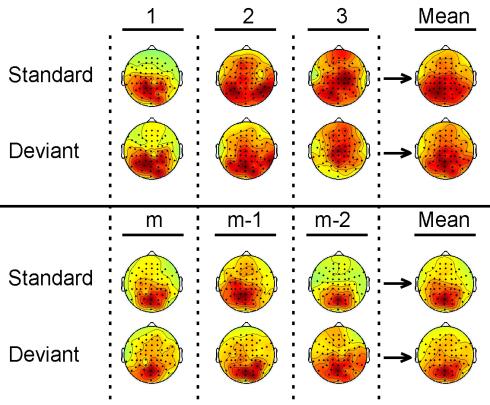 73 P8 Visual deviant stimuli produce mismatch responses in the amplitude dynamics of neuronal oscillations Sergei Tugin 1,2, Julio C. Hernandez-Pavon 1,2, Vadim V. Nikulin 3, Risto J.