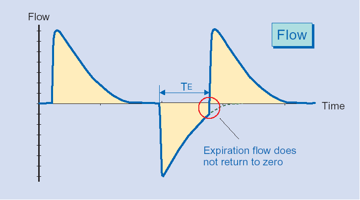 Vad är auto-peep (air trapping) Air trapping innebär att patienten till följd