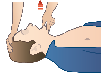 Andningskontroll Alla muskler i kroppen slappnar av vid medvetslöshet. Tungan som är en muskel slappnar också av och faller bakåt i svalget när man ligger på rygg.