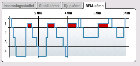 REM-sömn Drömsömn - REMsömn Rapid Eye Movement Sleep (snabba ögonrörelser) utgör den klassiska drömsömnen. Den bör omfatta 20-25% av den totala sömntiden.