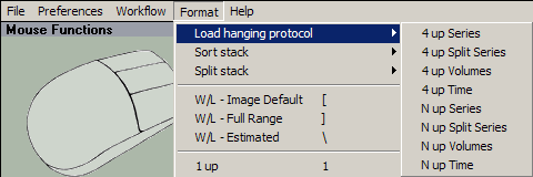 Format-menyn - Load hanging protocol (ladda anpassat protokoll): c. Välj protokollet N up Time (n upp tid). Softread-fönstret omarrangeras för att visa så många visningsprogram som får plats.