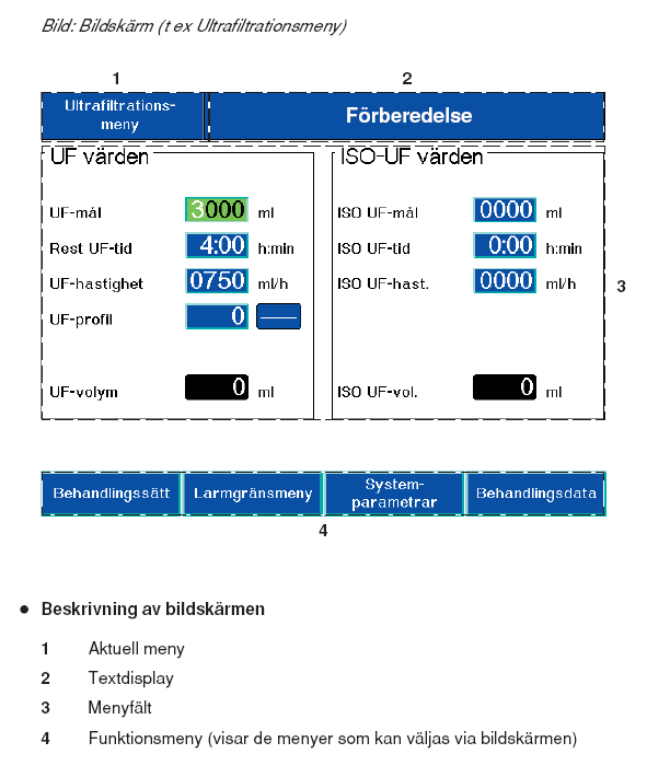 Delprocess 2: Priming av slangset När T1test är slutfört utan anmärkning kopplas dialysatslangarna till filtret.