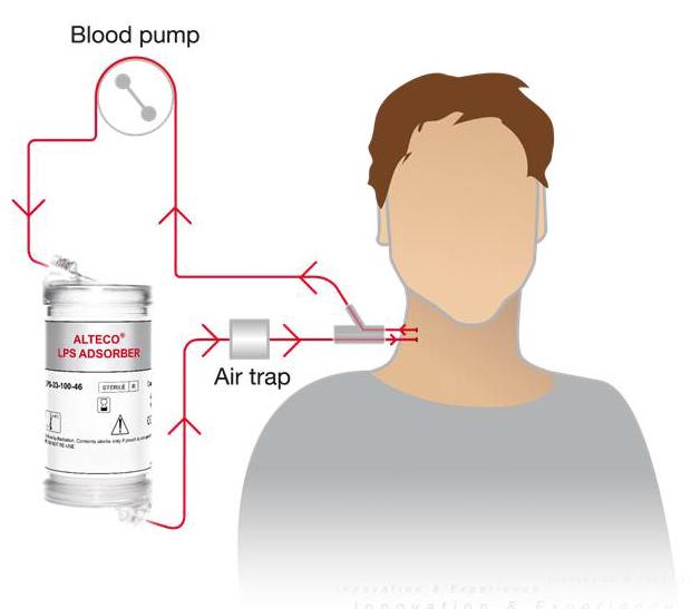 Alteco LPS Adsorber Alteco LPS Adsorber är en färdigutvecklad CE-märkt (klass IIa) medicinteknisk produkt som reducerar lipopolysackarid (LPS) i blodet hos patienter med gramnegativ sepsis (svår