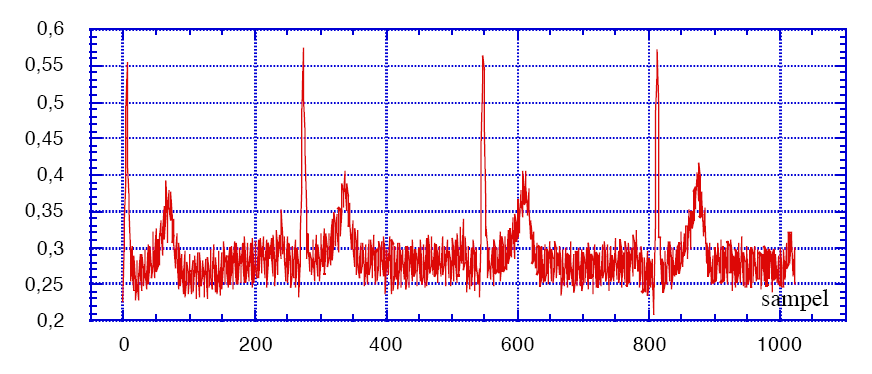 Exempel på sampling av en EKG-signal Uppgift: Figuren visar ett EKG-diagram som är samplat med ett digitalt oscilloskop. Samplingsfrekvensen är 300 Hz och antalet sampel N=1024.