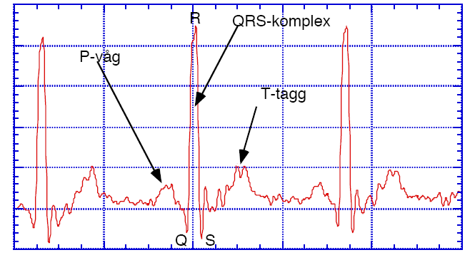 a) Med Fs = 300 Hz får vi en maximalt tillåten frekvens på 150 Hz (Fs/2) för att undvika vikningsdistortion. b) Fs = 300 Hz ger en samplingstid på 3,33 ms.