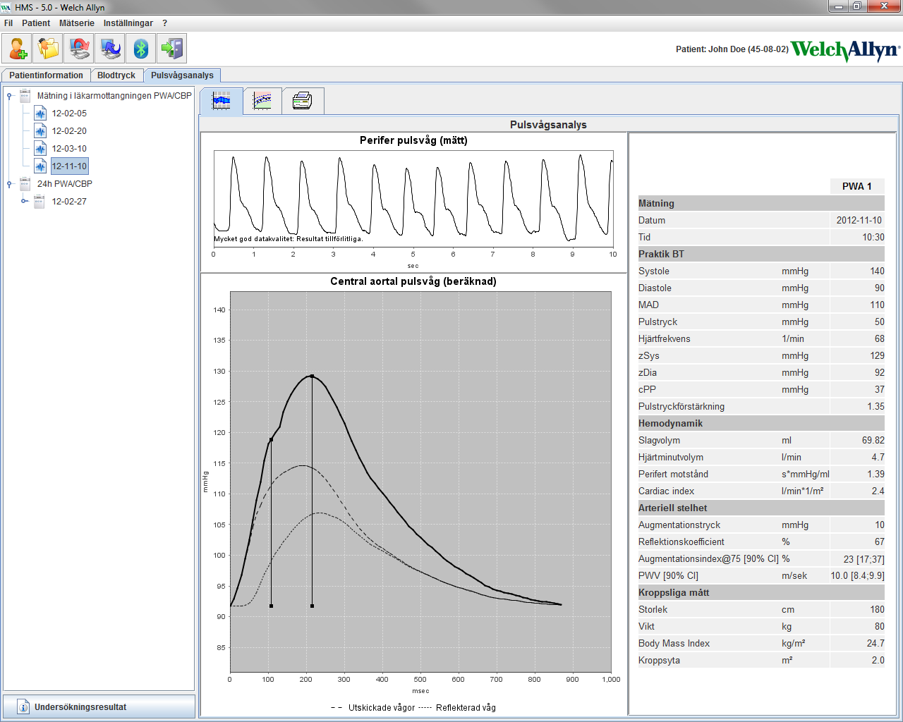 45 - Pulsvågsanalys (PWA). Från 10 pulsvågsmätningar bestäms en filtrerad och genomsnittlig pulsvåg som används för att beräkna den centrala aortapulsvågen.