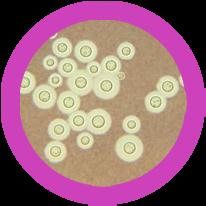 Penicillium Saccharomyces Tinea Stachybotrys Maximal storlek (nm)... 332 000 Antal arter... 16 Fara för människor... 64 Nytta för människor... 198 Antibiotikaresistens.