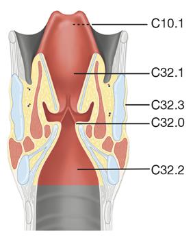 LARYNXCANCER 12.12 Larynxcancer 12.12.1 Översikt ICD-10 Främre (linguala) ytan av struplock (epiglottis) C10.1 Stämband (glottis) C32.0 Supraglottis (inklusive laryngeala ytan av epiglottis) C32.