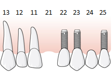 69 (137) 6.4.1 Regel E.