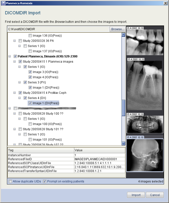BILDHANTERINGSMODUL 1.3.1 DICOMDIR Import DICOMDIR Import låter dig importera en uppsättning med flera patienter med deras patientinformation och patientbilder från DICOMDIR till Romexis.