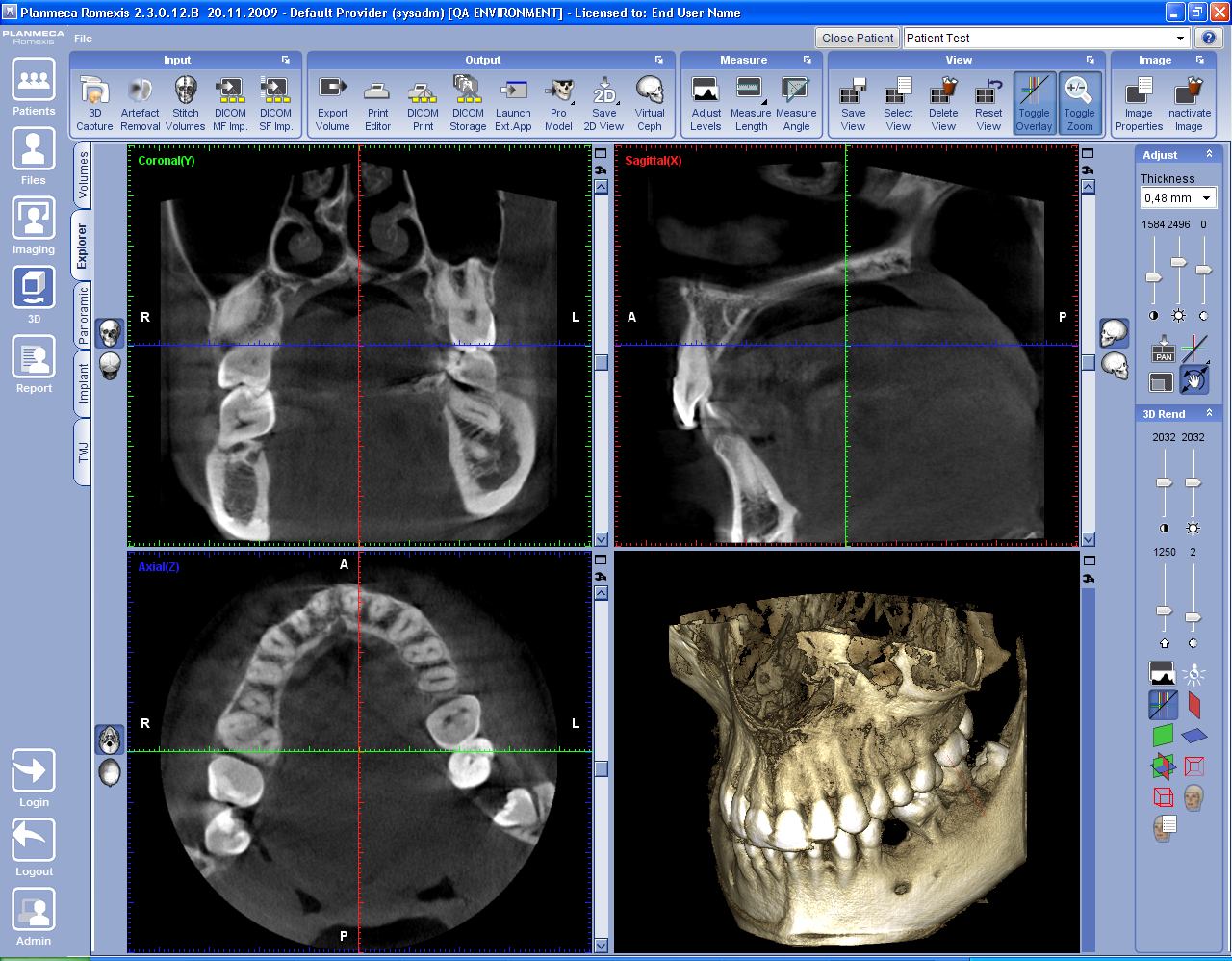 3D-UTFORSKAREN 2 3D-UTFORSKAREN I Romexis 3D Explorer kan man ta 3D-volymer, öppna och justera befintliga volymer såväl som visa dem i tre olika riktningar.