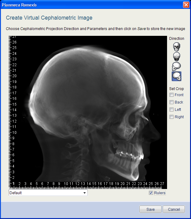 3D-UTFORSKAREN 2.1.10 Virtuell Kefalometri Virtuell Kefalometri kan användas för att skapa 2D-kefalometribilder från 3D-volymdata och spara dem i patienternas 2D-bilder.
