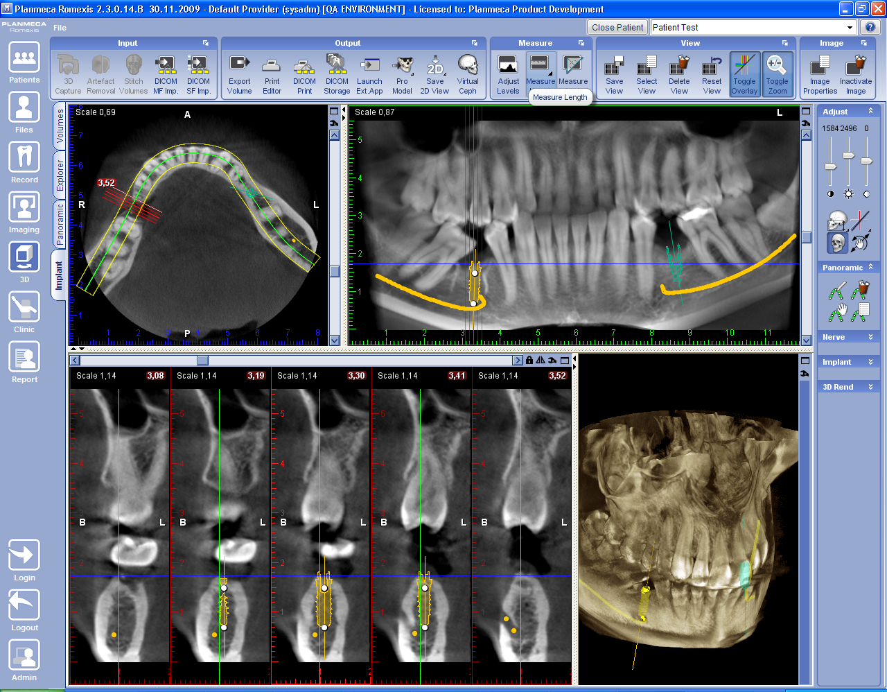 3D-TVÄRSNITTSMODUL (TILLVAL) 4 3D-TVÄRSNITTSMODUL (TILLVAL) OBS Om du har köpt en Romexis implantatlicens, kommer fliken Tvärsnitt att ersättas av fliken Implantat.