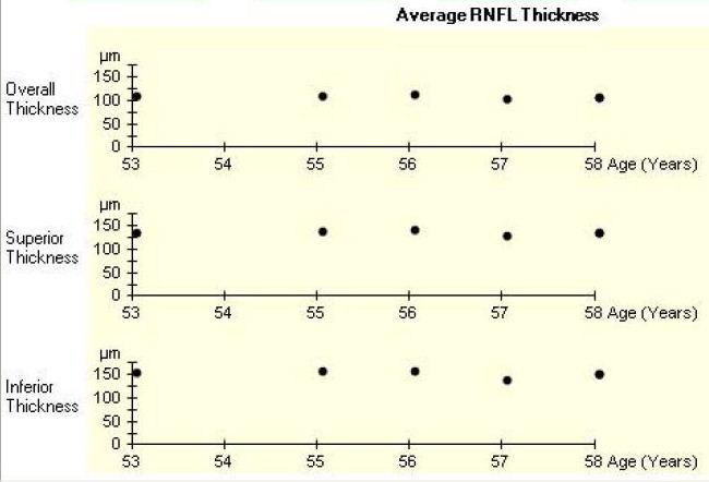 1 Tjocklek papillen samt Medelvärde på RNFL Förutom OCT-bilden på papillen kan man utifrån en databas få tjockleken på den optiska disken i µm, se fig.