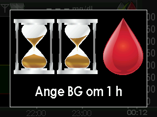 4 1. När denna kalibreringsuppmaning visas innebär det att det är dags att kalibrera med ett enda blodglukosvärde. Du bekräftar uppmaningen genom att trycka på VÄLJ.