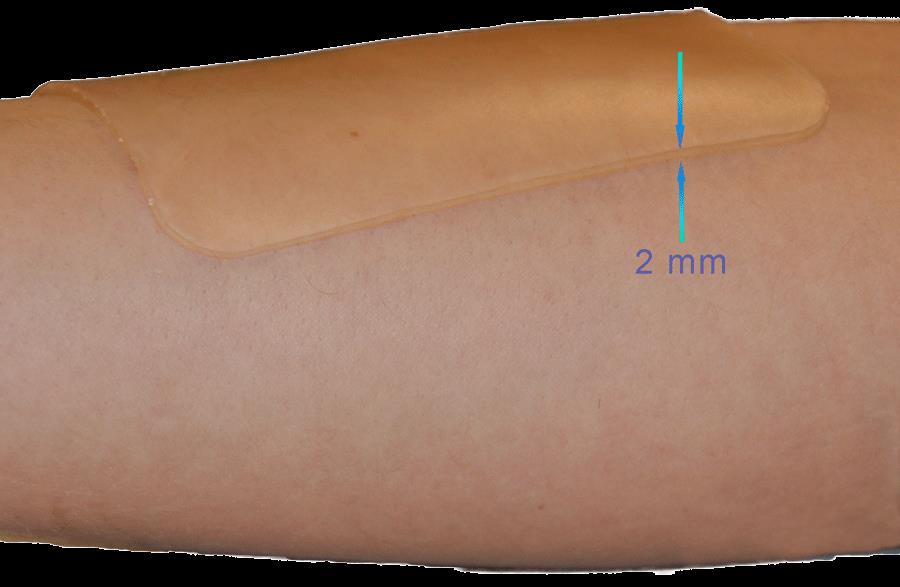 Superabsorberande Antimikrobiellt Gelförband 6,00 Beskrivning: AbsoClear Gel 10x10cm AbsoClear är ett superabsorberande transparent hydrogel förband, tillverkad av jonisk polymer och glycerol,