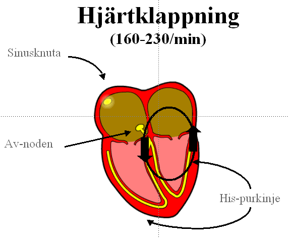 Sinusknuta