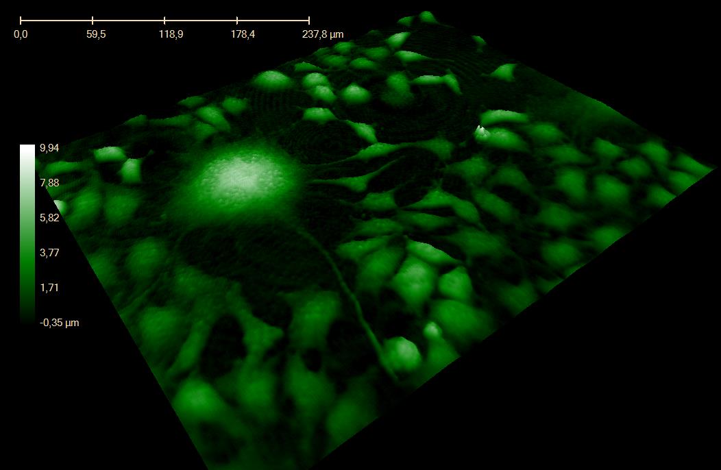 INBJUDAN TILL TECKNING AV AKTIER Emissionsbeslut och emissionsvolym Vid extra bolagsstämma i Phase Holographic Imaging PHI AB (publ) den 8 november 2013 beslutades att genomföra en ökning av