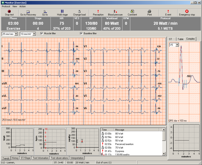 2. Spela in ett arbets-ekg 2.1 Monitorskärmen Monitorskärmen visas när du startar ett nytt arbets-ekg.