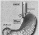 Sjukdomar i esofagus: 1. Motilitetsrubbningar Achalasi: Nervskada i distala esofagus, med olika orsaker.