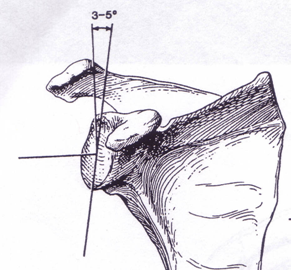 Anatomi Stabiliteten grundar sig påp Fossa glenoidale Labrum Kapsel Ligament Intraartikulärt rt tryck Dynamiska stabilisatorer Anatomi Fossa glenoidale Ledpannan ca 3 till 4 gånger mindre Normala