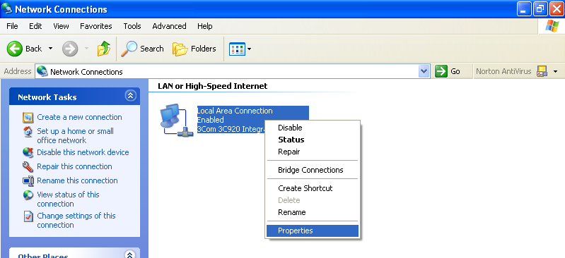 Uppställning av projektorns nätverksmiljö. Inställning av en IPadress för datorn Det följande beskriver inställningar för Windows XP (Professional eller Home Edition).