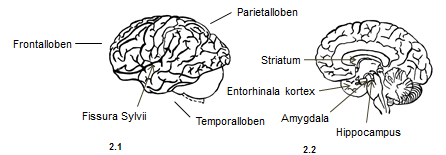 Skiss ritad av Broomé, I. (2011) Figur 2. Hjärnan sett från sidan samt i genomskärning med relevanta områden namngivna. 2.1 Vänster hemisfärs laterala yta. 2.2 Medialt sagitalsnitt som visar subkortikala strukturer.