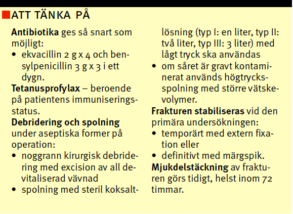 6 Öppna underbensfrakturer Direkt och högenergetiskt våld, oftast idrottsskador eller trafikolyckor. Akut handläggning. Antibiotikaprofylax Cefalosporinpreparat ex. Zinacef 1.5 g x 3 i.v. som påbörjas direkt på akutmottagningen efter sårodling [6].