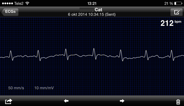 Figur 3. Ett registrerat AliveCor EKG i läge för ett screenshot. Figur 4. a) Zoomning av ett screenshot Figur 4.